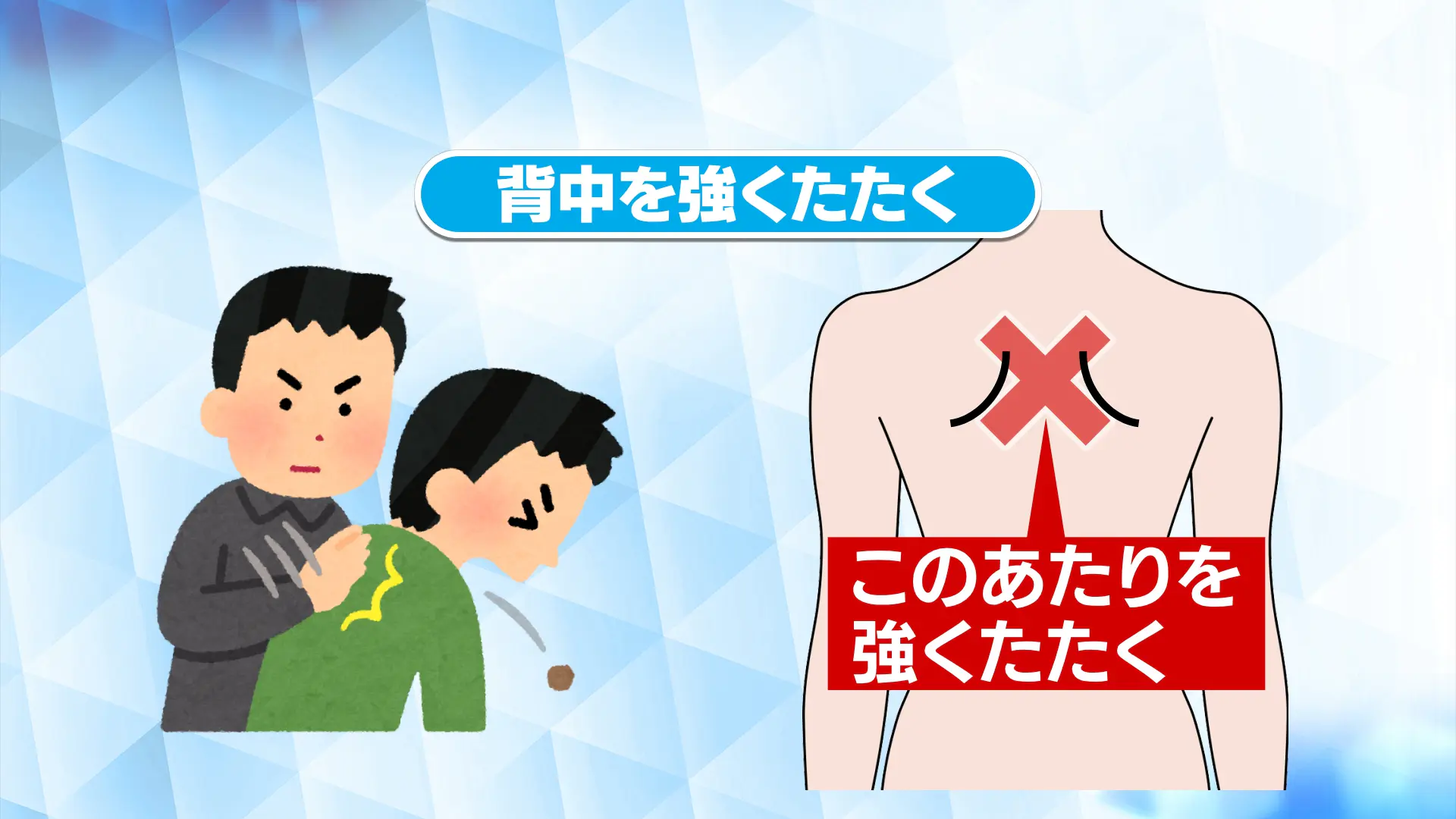 食べ物をのどに詰まらせたときのサインは？背中のどの辺を叩く？どう対処したらいい？【いっちゃん☆メディコ】｜いっちゃん☆メディコ｜KNB WEB ...